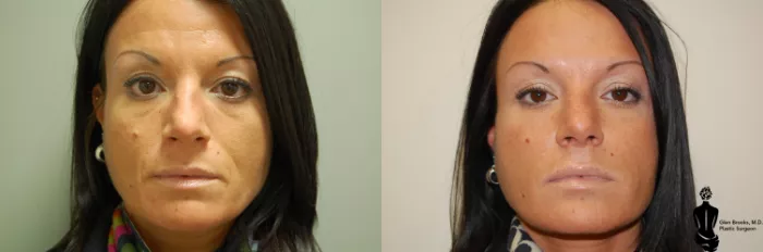 35 Beauty rs Before And After